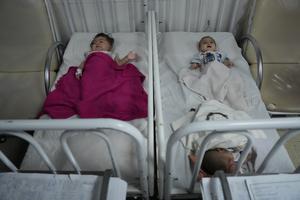 AFGANISTAN-KABUL-NIÑOS-DESNUTRICION