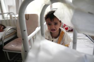 AFGANISTAN-KABUL-NIÑOS-DESNUTRICION