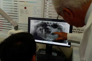 MEXICO-CIUDAD DE MEXICO-CANCER BUCAL